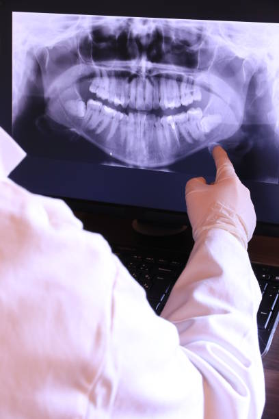 Best Emergency Tooth Extraction in Delhi Hills, OH